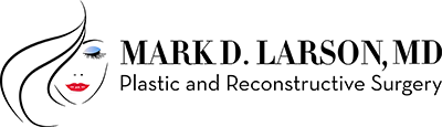 Mark Larson M.D.